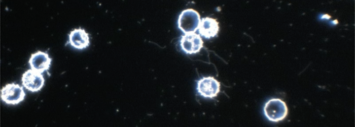 Borreliose borreliose